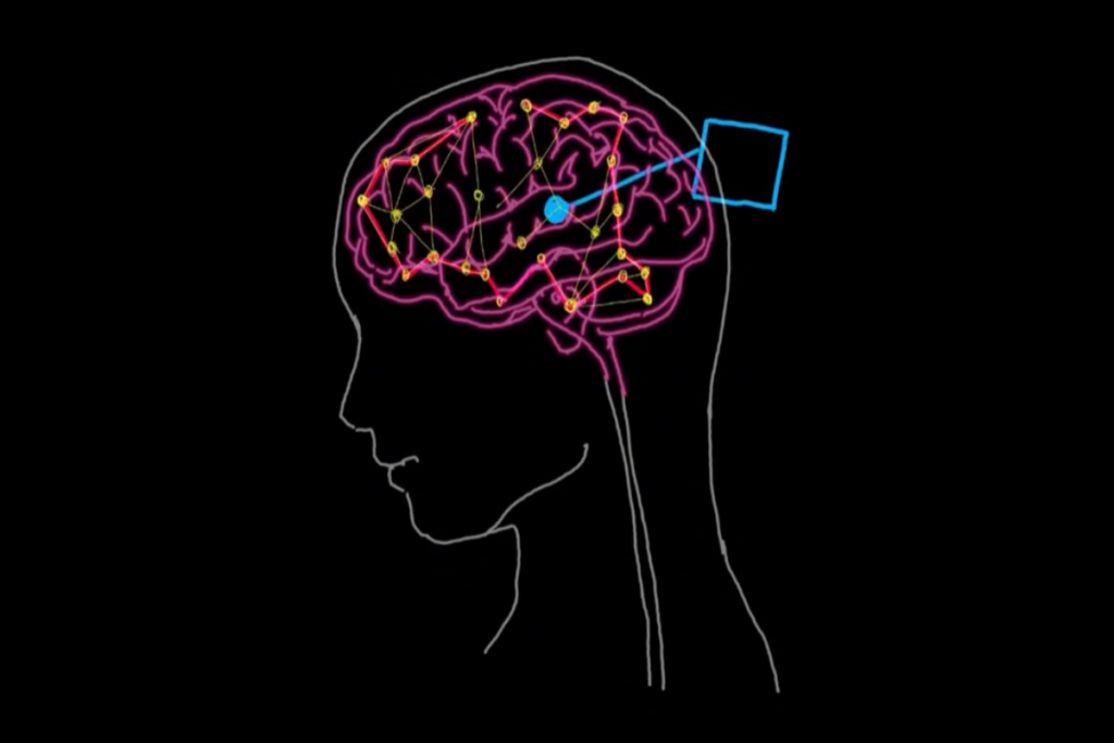 brain1200800_2 - 成果報酬型 経営コンサルティング